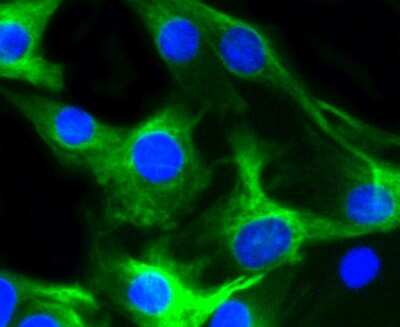 Immunocytochemistry/ Immunofluorescence: Desmin Antibody (SI18-00) [NBP2-67407]