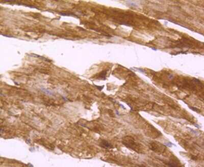 Immunohistochemistry-Paraffin: Desmin Antibody (SI18-00) [NBP2-67407]