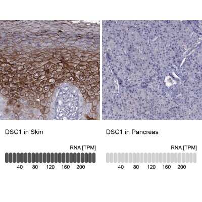 Immunohistochemistry-Paraffin: Desmocollin-1 Antibody [NBP2-62695]