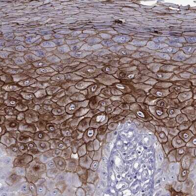 Immunohistochemistry-Paraffin: Desmocollin-1 Antibody [NBP2-62695]