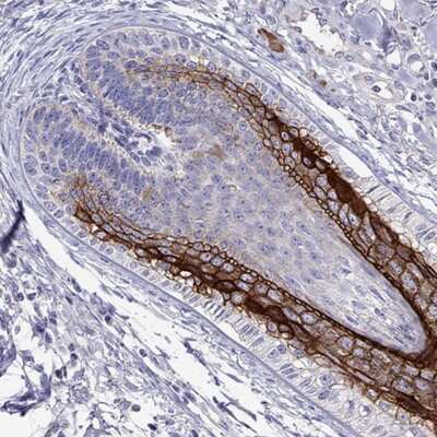 Immunohistochemistry-Paraffin: Desmocollin-1 Antibody [NBP2-62695]