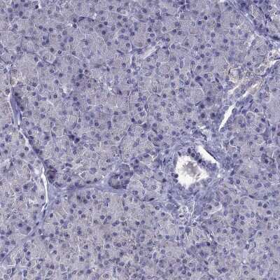 Immunohistochemistry-Paraffin: Desmocollin-1 Antibody [NBP2-62695]