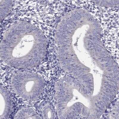 Immunohistochemistry-Paraffin: Desmocollin-1 Antibody [NBP2-62695]
