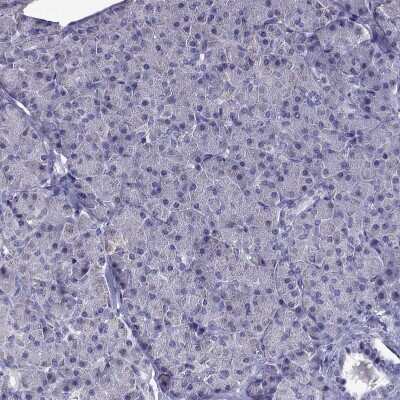 Immunohistochemistry-Paraffin: Desmocollin-1 Antibody [NBP2-62695]