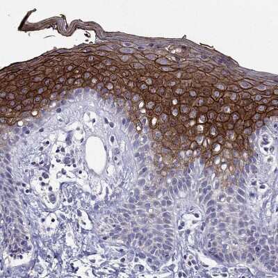 Immunohistochemistry-Paraffin: Desmocollin-1 Antibody [NBP2-62695]