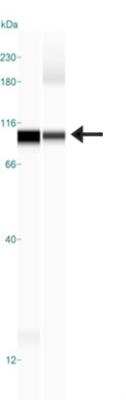 Simple Western: Desmocollin-1 Antibody [NBP1-88099]