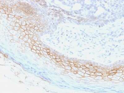 Immunohistochemistry-Paraffin: Desmocollin-2 Antibody (7G6) - Azide and BSA Free [NBP2-54519]