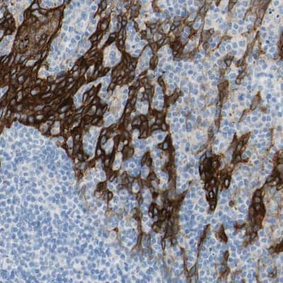 Immunohistochemistry-Paraffin: Desmocollin-2 Antibody [NBP1-85710]