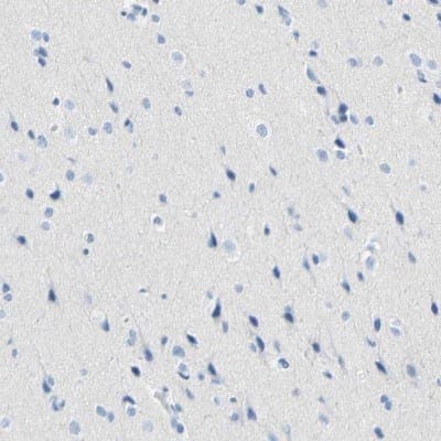 Immunohistochemistry-Paraffin: Desmocollin-2 Antibody [NBP1-85710]
