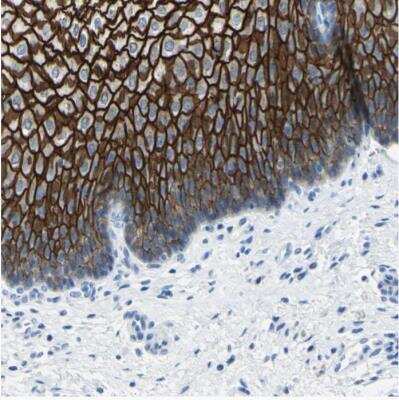 Immunohistochemistry-Paraffin: Desmocollin-2 Antibody [NBP1-85711]