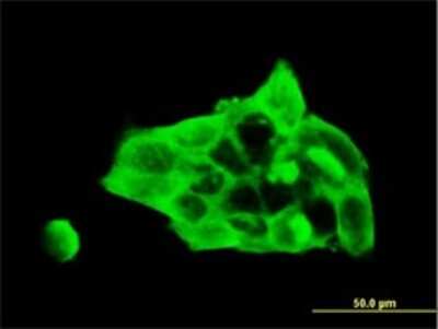 Immunocytochemistry/ Immunofluorescence: Desmocollin-3 Antibody (4D2) [H00001825-M01]
