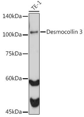 Western Blot: Desmocollin-3 Antibody (7H1O6) [NBP3-15266]