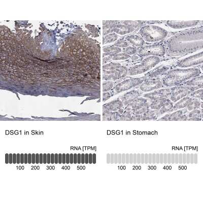 Immunocytochemistry/ Immunofluorescence: Desmoglein-1 Antibody [NBP3-17012]