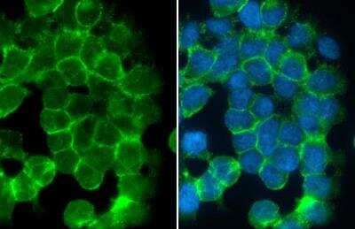 Immunocytochemistry/ Immunofluorescence: Desmoglein-2 Antibody [NBP1-33374]