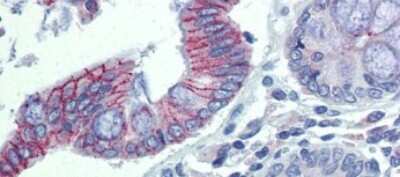 Immunohistochemistry-Paraffin: Desmoglein-2 Antibody [NBP1-59200]