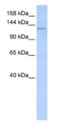 Western Blot: Desmoglein-2 Antibody [NBP1-59200]