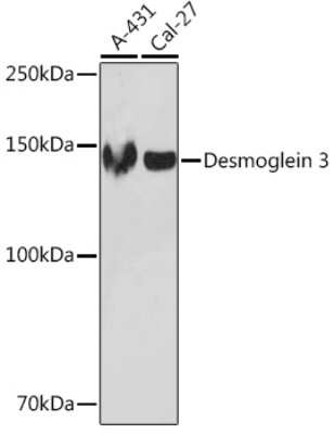 Western Blot: Desmoglein-3 Antibody (1T1D5) [NBP3-16597]