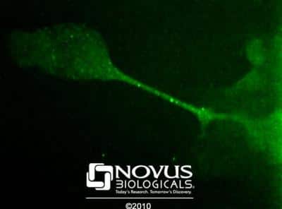 Immunocytochemistry/ Immunofluorescence: Desmoglein-3 Antibody (5G11) - BSA Free [NB100-1643]