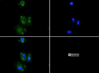 Immunocytochemistry/ Immunofluorescence: Desmoglein-3 Antibody (5H10) - Azide and BSA Free [NBP2-80695]