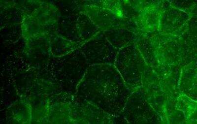 Immunocytochemistry/ Immunofluorescence: Desmoglein-3 Antibody (5H10) [NBP1-78984]