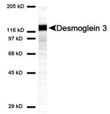 Western Blot: Desmoglein-3 Antibody (5H10) [NBP1-78984]