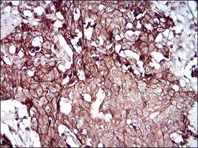 Immunohistochemistry-Paraffin: Desmoglein-3 Antibody (6G2C11) - BSA Free [NBP2-37259]