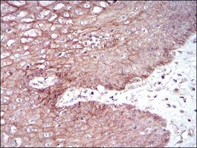 Immunohistochemistry-Paraffin: Desmoglein-3 Antibody (6G2C11) - BSA Free [NBP2-37259]