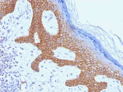 Immunohistochemistry-Paraffin: Desmoglein-3 Antibody (DSG3/1535) [NBP3-07873]