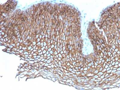 Immunohistochemistry-Paraffin: Desmoglein-3 Antibody (DSG3/2837) [NBP3-07875]