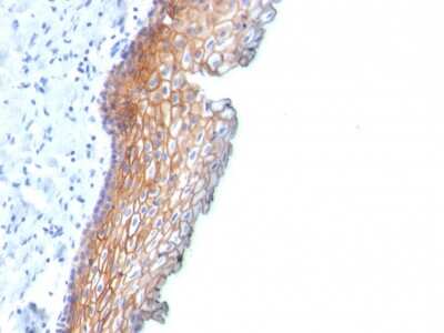 Immunohistochemistry-Paraffin: Desmoglein-3 Antibody (DSG3/2838) [NBP3-07876]