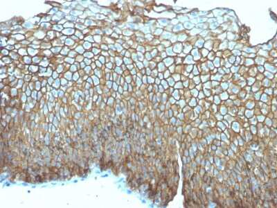Immunohistochemistry-Paraffin: Desmoglein-3 Antibody (DSG3/2839) [NBP3-07885]