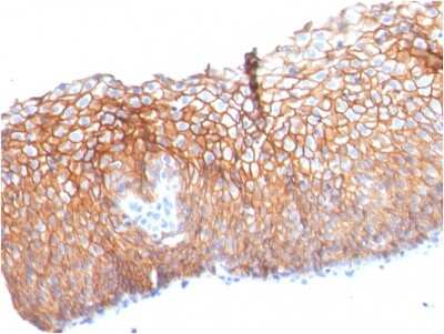 Immunohistochemistry-Paraffin: Desmoglein-3 Antibody (DSG3/2840) - Azide and BSA Free [NBP3-08509]