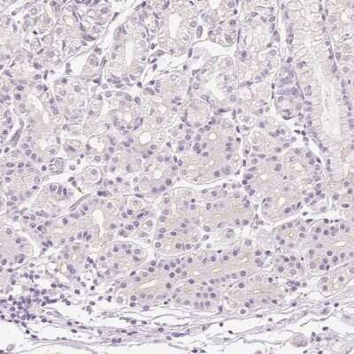 Immunohistochemistry-Paraffin: Desmoglein-3 Antibody [NBP2-54729]