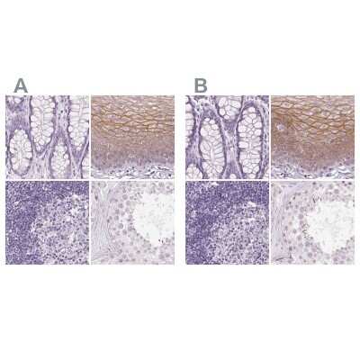 Immunohistochemistry-Paraffin: Desmoglein-3 Antibody [NBP2-54729]