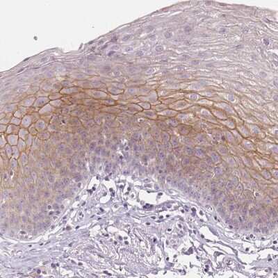 Immunohistochemistry-Paraffin: Desmoglein-3 Antibody [NBP2-54729]