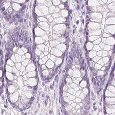 Immunohistochemistry-Paraffin: Desmoglein-3 Antibody [NBP2-54729]