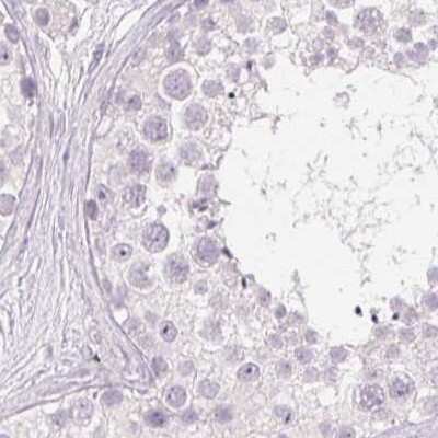 Immunohistochemistry-Paraffin: Desmoglein-3 Antibody [NBP2-54729]