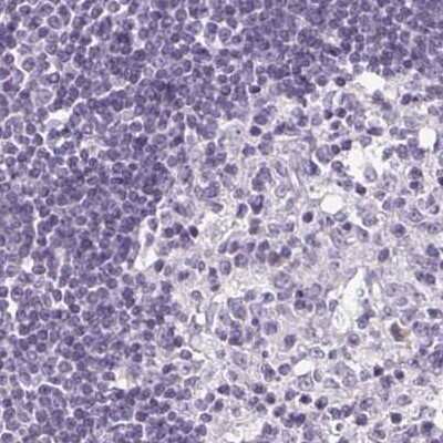 Immunohistochemistry-Paraffin: Desmoglein-3 Antibody [NBP2-54729]