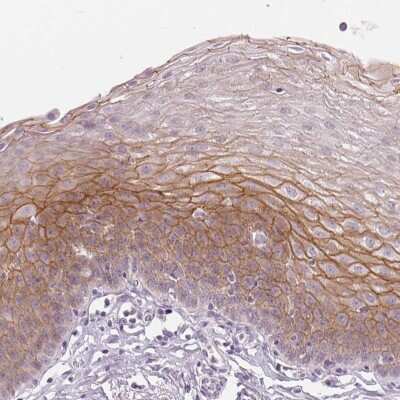 Immunohistochemistry-Paraffin: Desmoglein-3 Antibody [NBP2-54744]