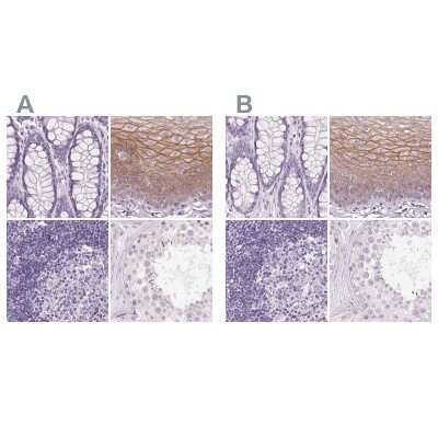 Immunohistochemistry-Paraffin: Desmoglein-3 Antibody [NBP2-54744]