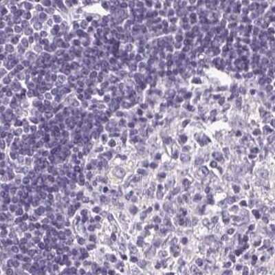 Immunohistochemistry-Paraffin: Desmoglein-3 Antibody [NBP2-54744]