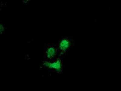Immunocytochemistry/ Immunofluorescence: Destrin Antibody (OTI2F7) [NBP2-00527]