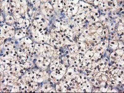 Immunohistochemistry-Paraffin: Destrin Antibody (OTI2F7) [NBP2-00527]