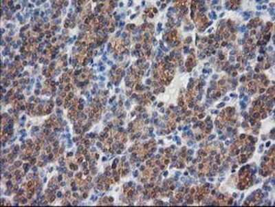 Immunohistochemistry-Paraffin: Destrin Antibody (OTI2F7) [NBP2-00527]