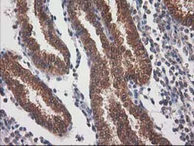 Immunohistochemistry-Paraffin: Destrin Antibody (OTI2F7) [NBP2-00527]