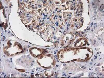 Immunohistochemistry-Paraffin: Destrin Antibody (OTI2F7) [NBP2-00527]