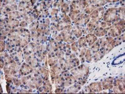 Immunohistochemistry-Paraffin: Destrin Antibody (OTI2F7) [NBP2-00527]