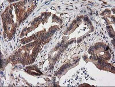 Immunohistochemistry: Destrin Antibody (OTI2F7) - Azide and BSA Free [NBP2-71669]