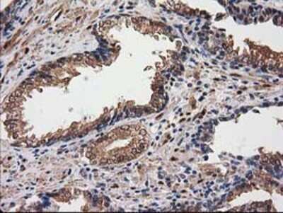 Immunohistochemistry: Destrin Antibody (OTI2F7) - Azide and BSA Free [NBP2-71669]