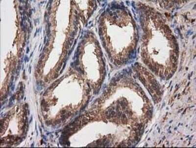 Immunohistochemistry: Destrin Antibody (OTI2F7) - Azide and BSA Free [NBP2-71669]